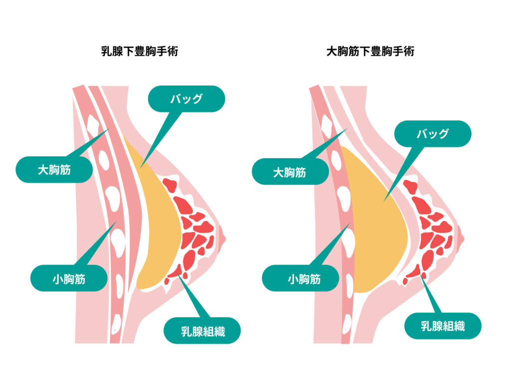 AV女優募集 求人