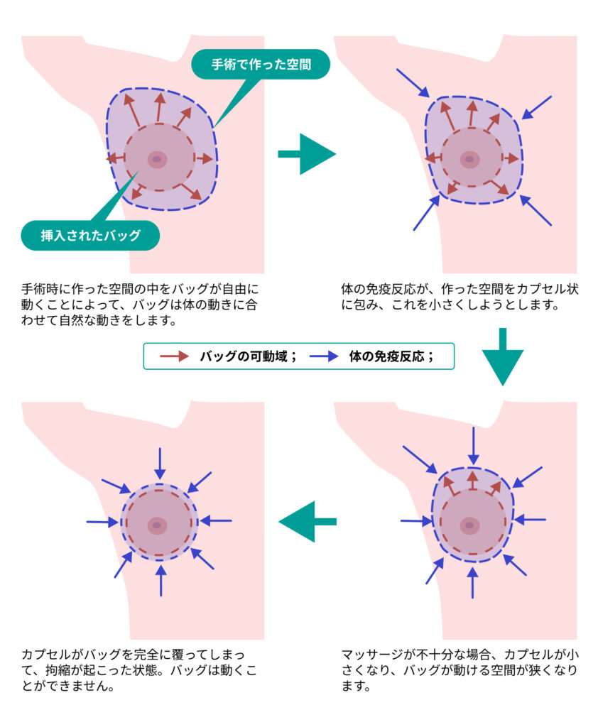 AV女優募集 求人